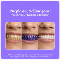 Perfora Fluoride+ Purple Magic Whitening Toothpaste