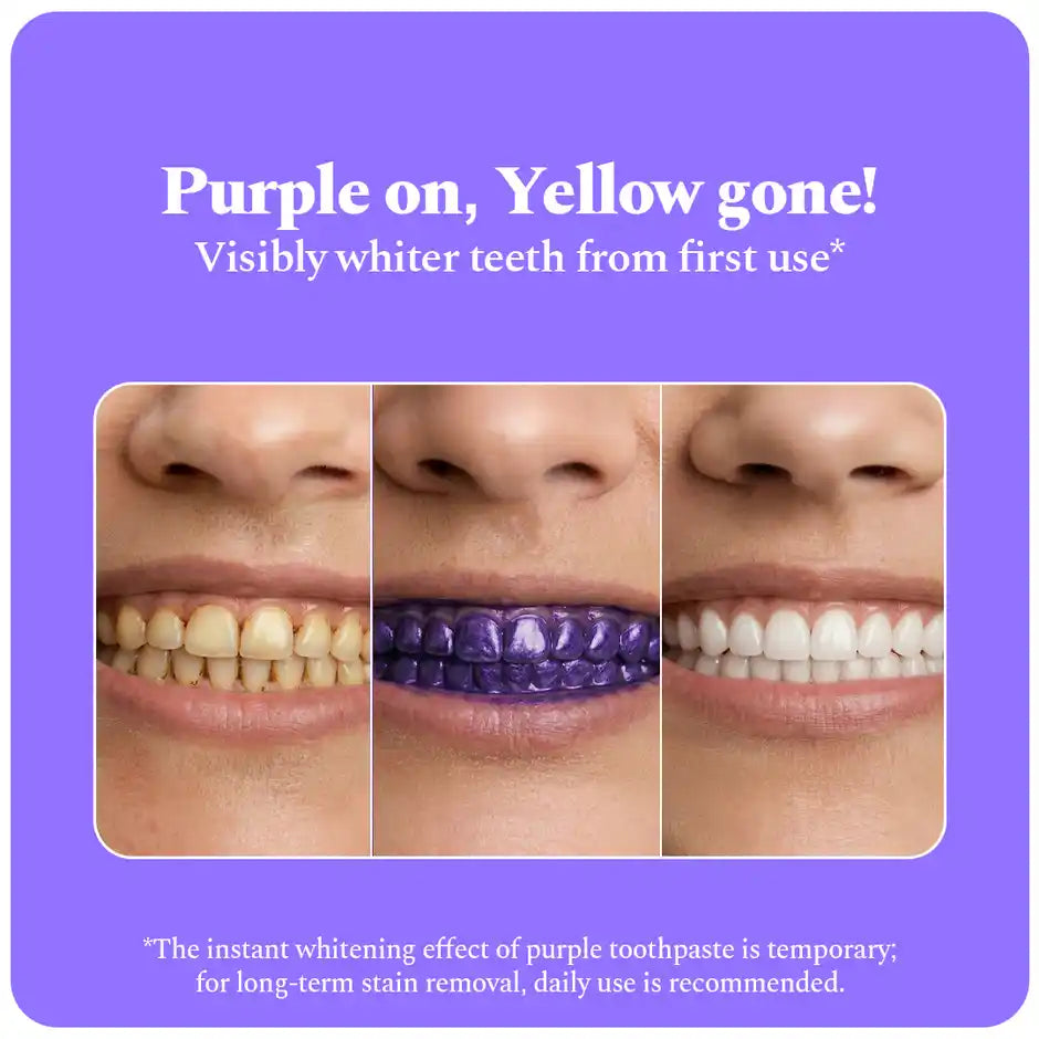 Perfora Fluoride+ Purple Magic Whitening Toothpaste